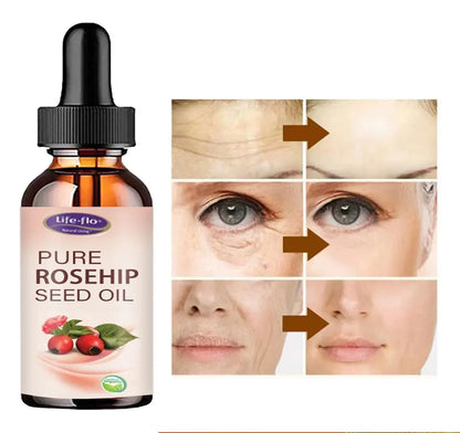 Rosehip Oil